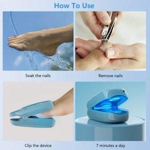 Nail Fungus Laser Cleaning Device 905nm 470nm Nail Care Machine Gift