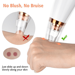 Blackhead Remover Pore Vacuum, Facial Pore Cleaner, Electric Acne Comedone Whitehead Extractor Tool, USB Rechargeable Blackhead Vacuum Kit For Women & Men